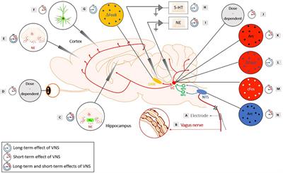 How Is the Norepinephrine System Involved in the Antiepileptic Effects of Vagus Nerve Stimulation?